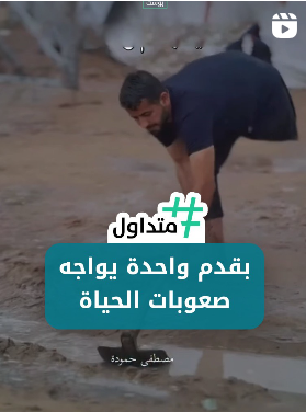 بقدم واحدة يواجه صعوبات الحياة