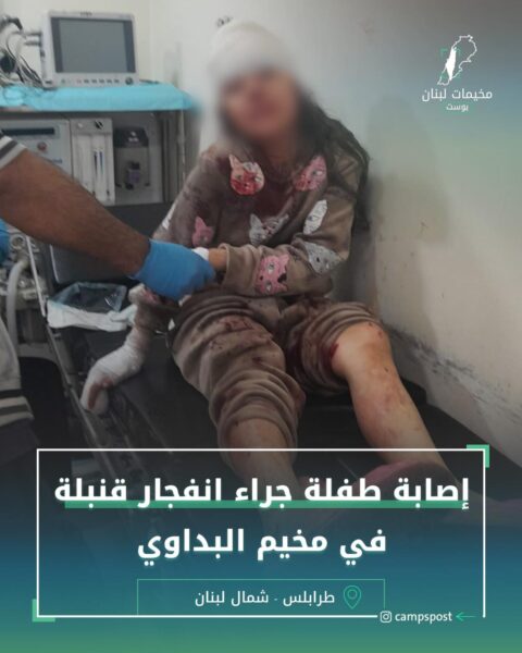 إصابة طفلة بإنفجار قنبلة في البداوي