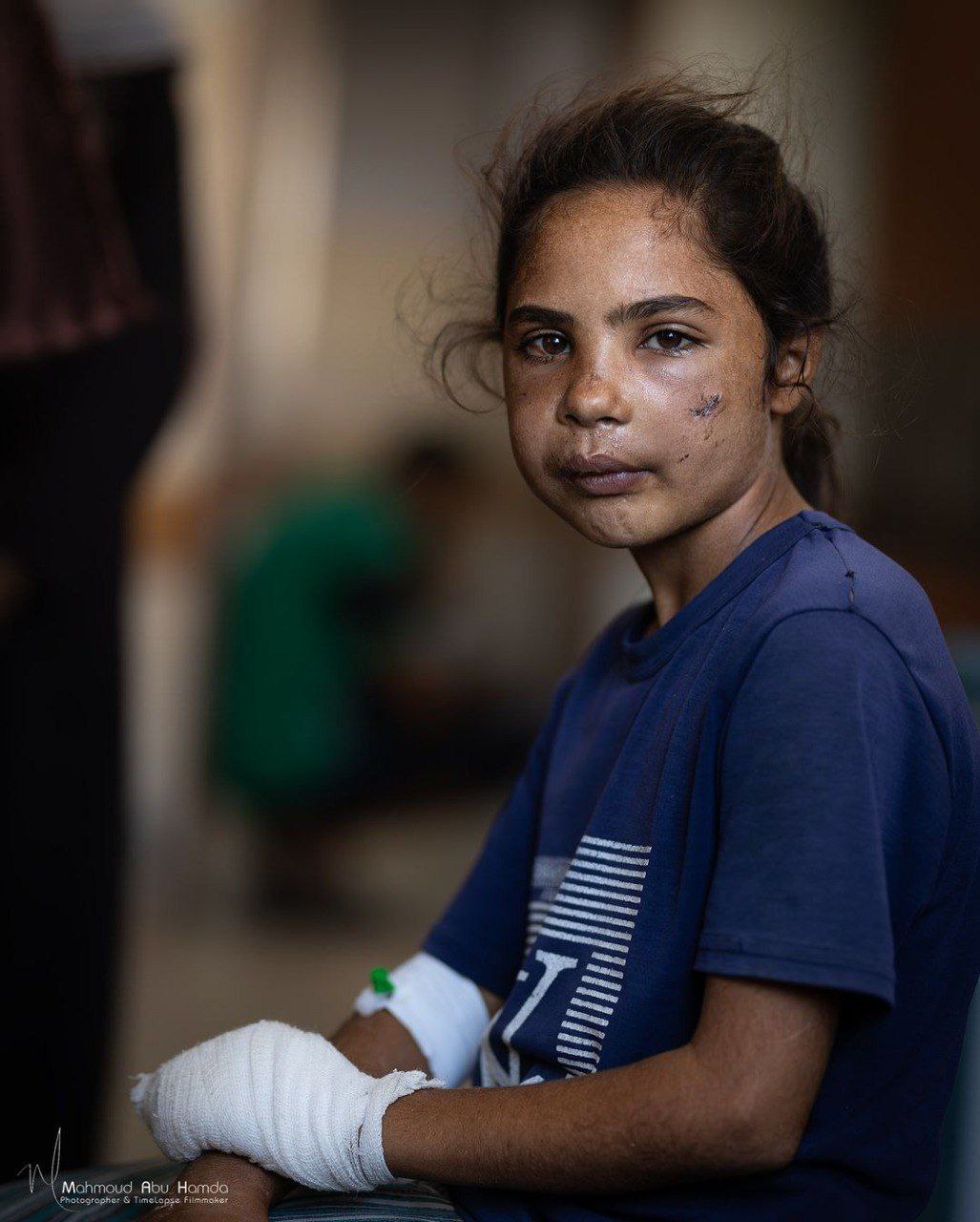 🔴 مأساة الطفلة “بروج” في قطاع غزة.. 

رصاصة واحدة من…