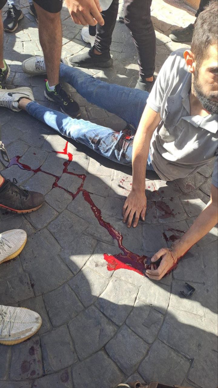 🚨 عاجل | الجزيرة: انفجار أجهزة اتصال يحملها عناصر من…