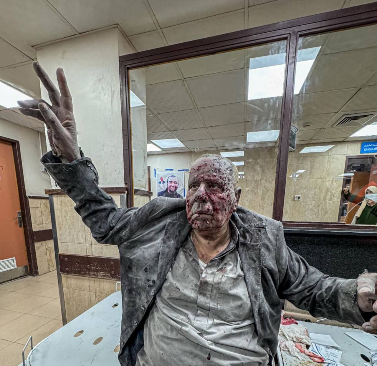 مسن فلسطيني يرفع شارة النصر رغم أصابته بفعل غارات الاحتلال…