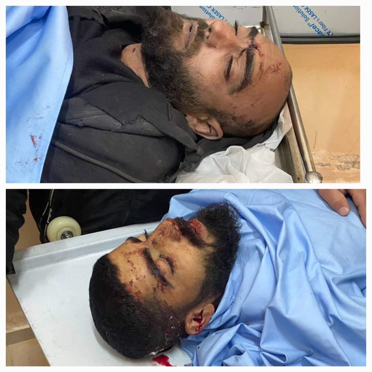 الشهيدان بقصف الاحتلال على محيط بلدة عقابا قرب طوباس بالضفة…