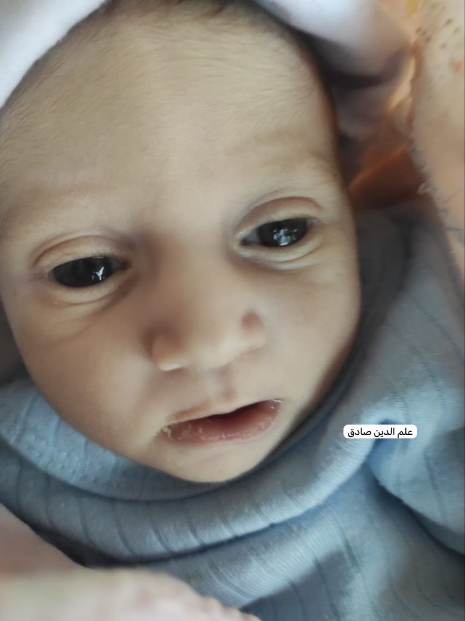 الطفلة الرضيعة عائشة القصاص تبلغ من العمر عشرين يومًا استشهــدت…