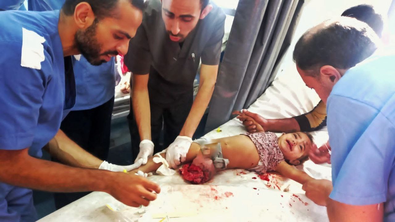 🔴 صورة مؤلمة.. الطفلة زينة بترت قدمها جراء قصف الاحتلال…