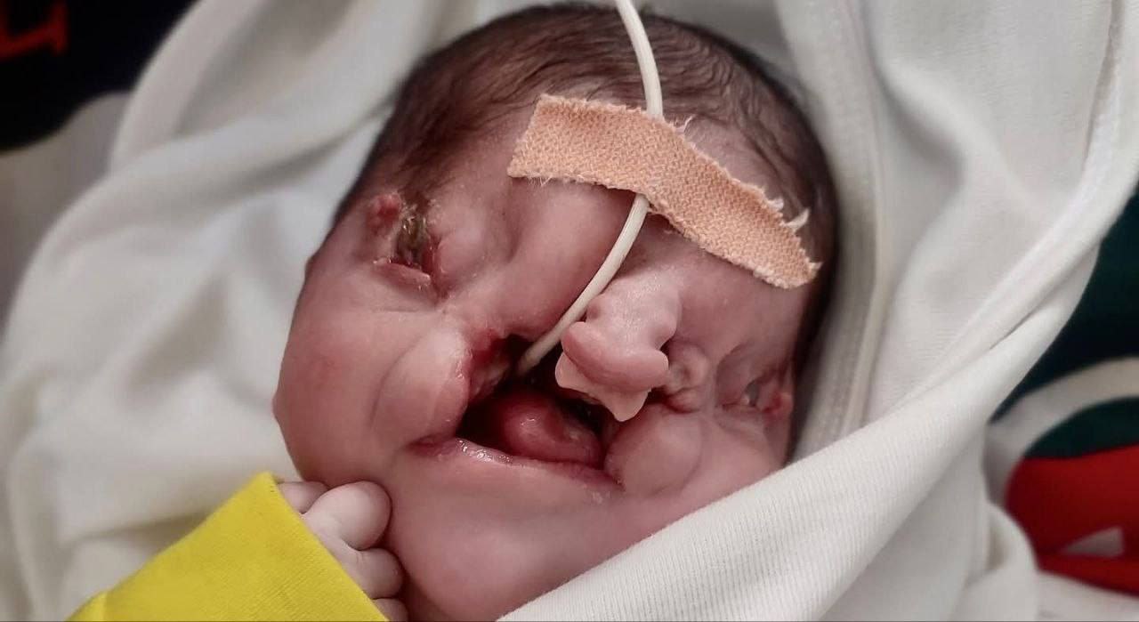 كتب مدير عام وزارة الصحة في غزة، د. منير البرش،…