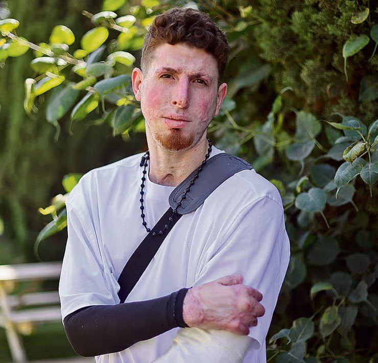 🔴 جندي من جيش الاحتلال أصيب بعد انفجار عبوة زرعتها…