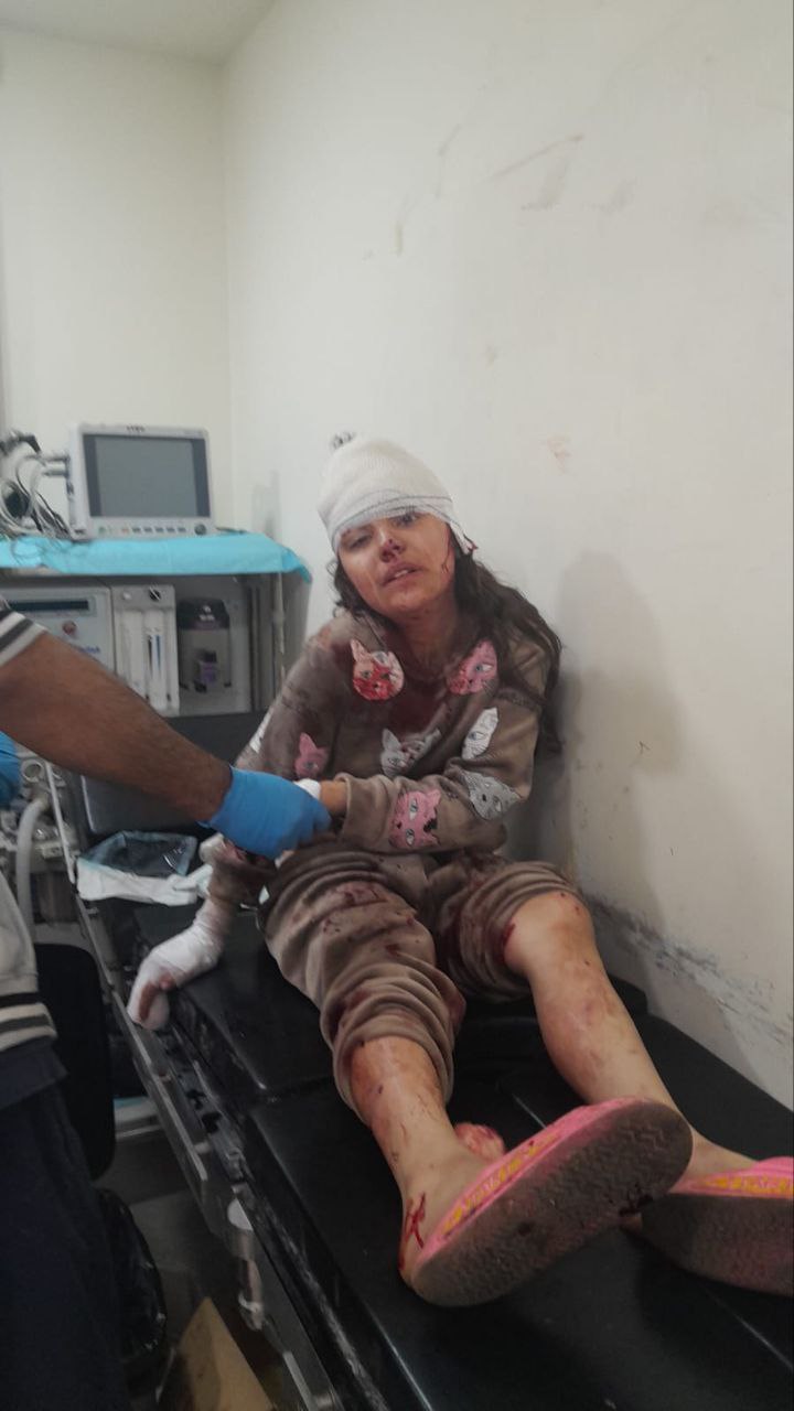 إصابة طفلة بعدة شظايا بعد إلقاء قنبلة في مخيم البداوي.