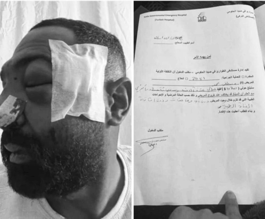 أُصيب الشاب مصطفى محمد، من مخيم عين الحلوة، في رأسه…